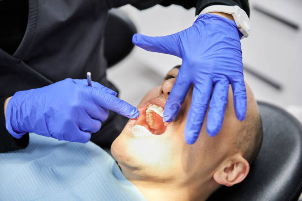 Best Chipped Tooth Repair Near Me  in Rainsville, AL